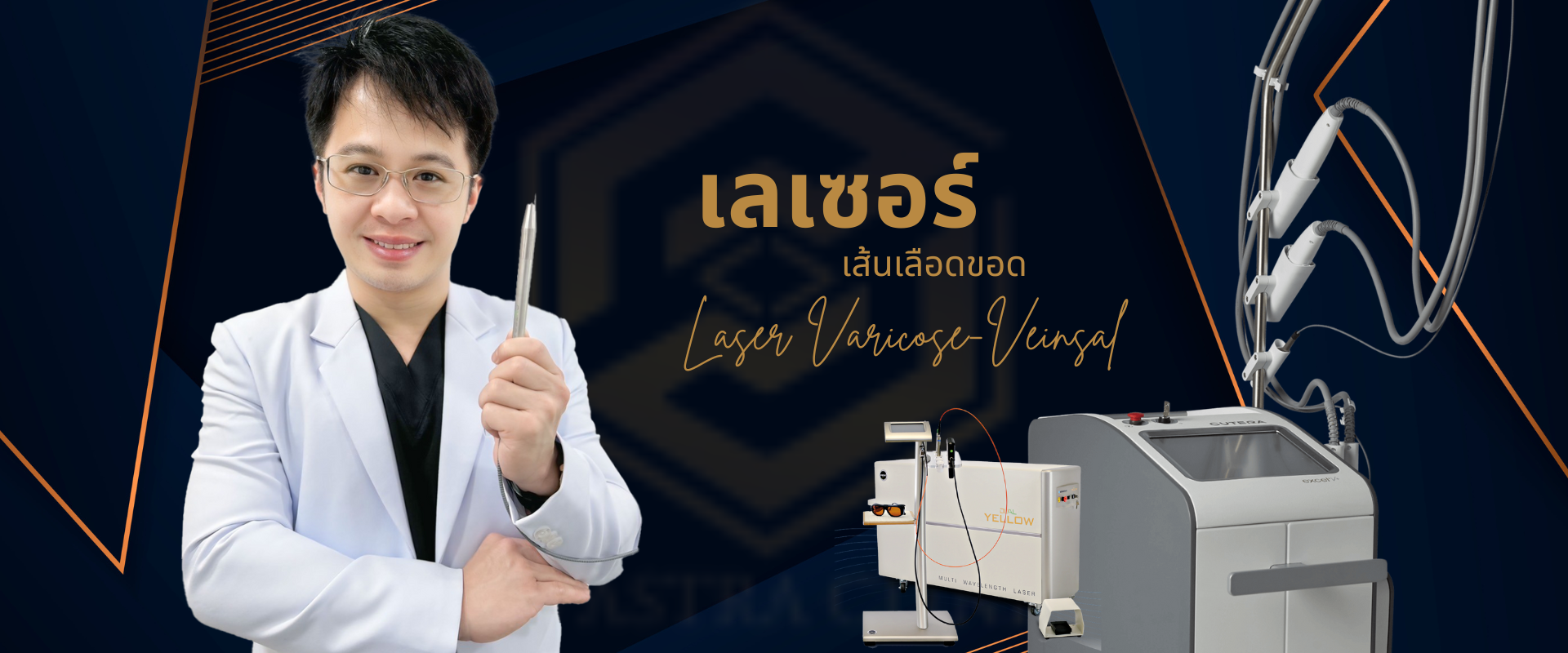 Laser - varicose-veins